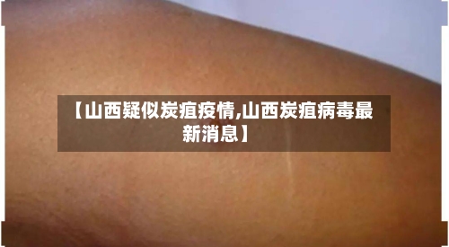 【山西疑似炭疽疫情,山西炭疽病毒最新消息】-第1张图片