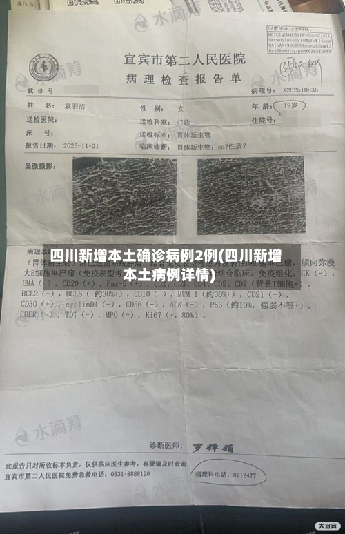 四川新增本土确诊病例2例(四川新增本土病例详情)-第1张图片